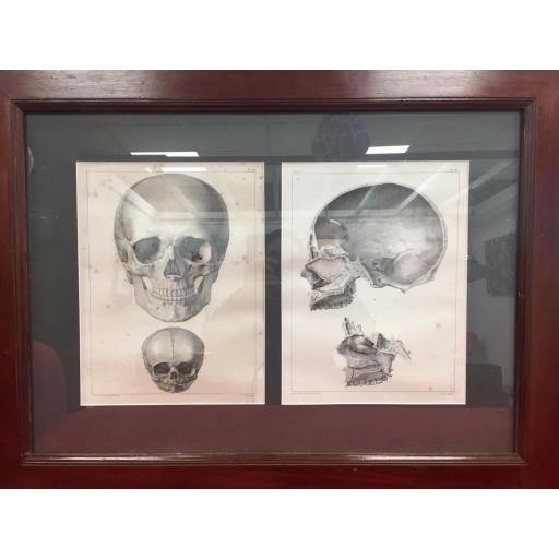 Vintage anatomy poster French Lithograph Framed Skull